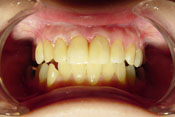 1-AFTER.jpg