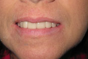 10-AFTER