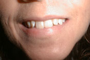 10-BEFORE