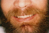 12-AFTER