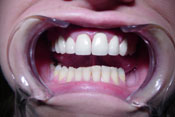 3-AFTER.jpg