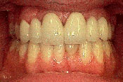 4-AFTER.jpg