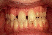 4-BEFORE.jpg
