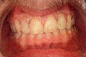 7-AFTER