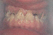 7-BEFORE