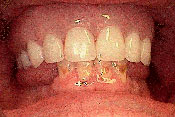 8-AFTER