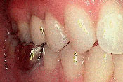 9-BEFORE
